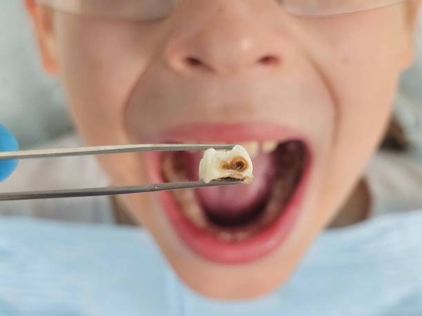 Best Orthodontic Emergency Dentist in Stansbury Park, UT
